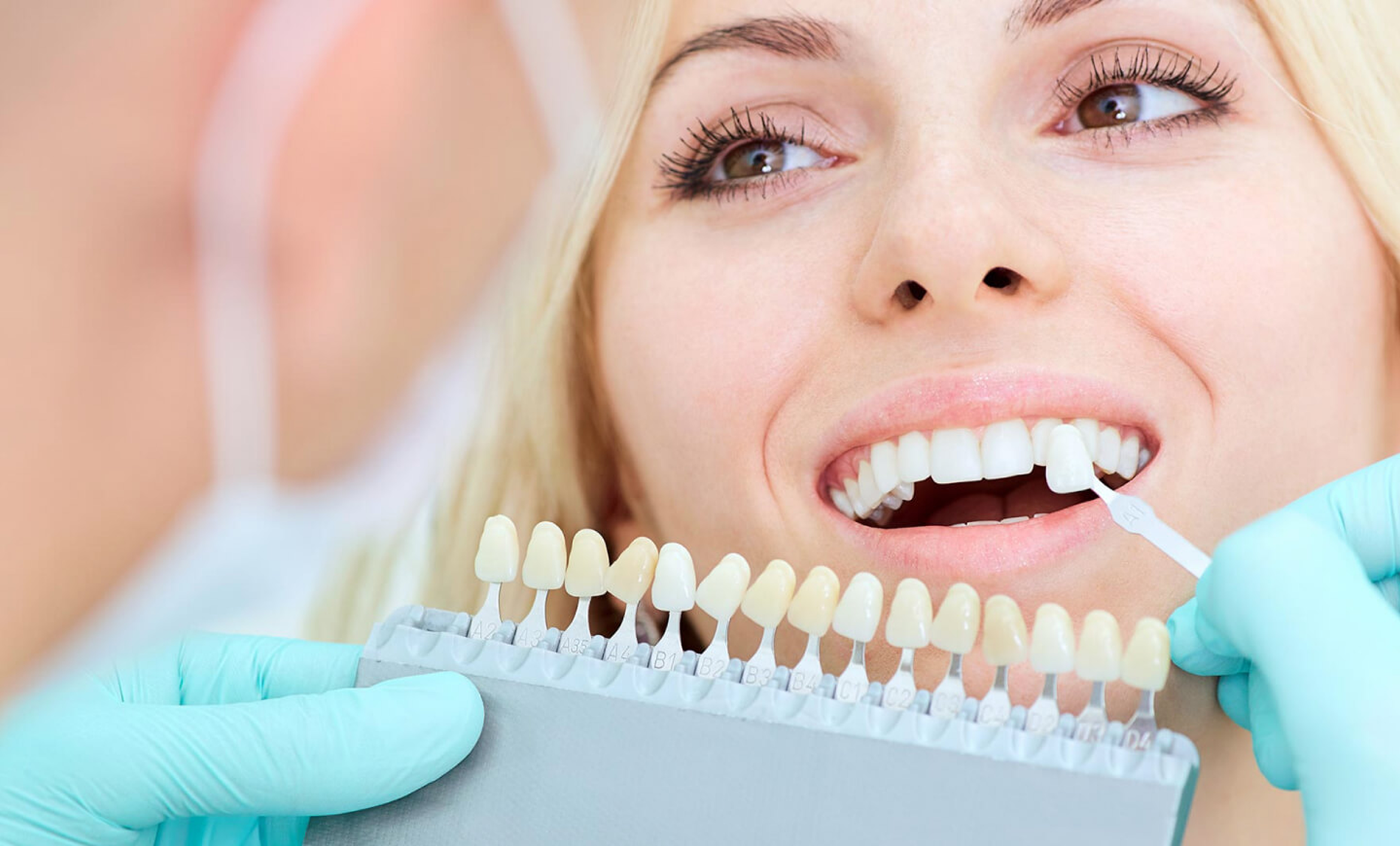 Эстетическая стоматология 2025: лучшие методы исправления улыбки и цены в Братске - новости стоматологии Меди в Братске